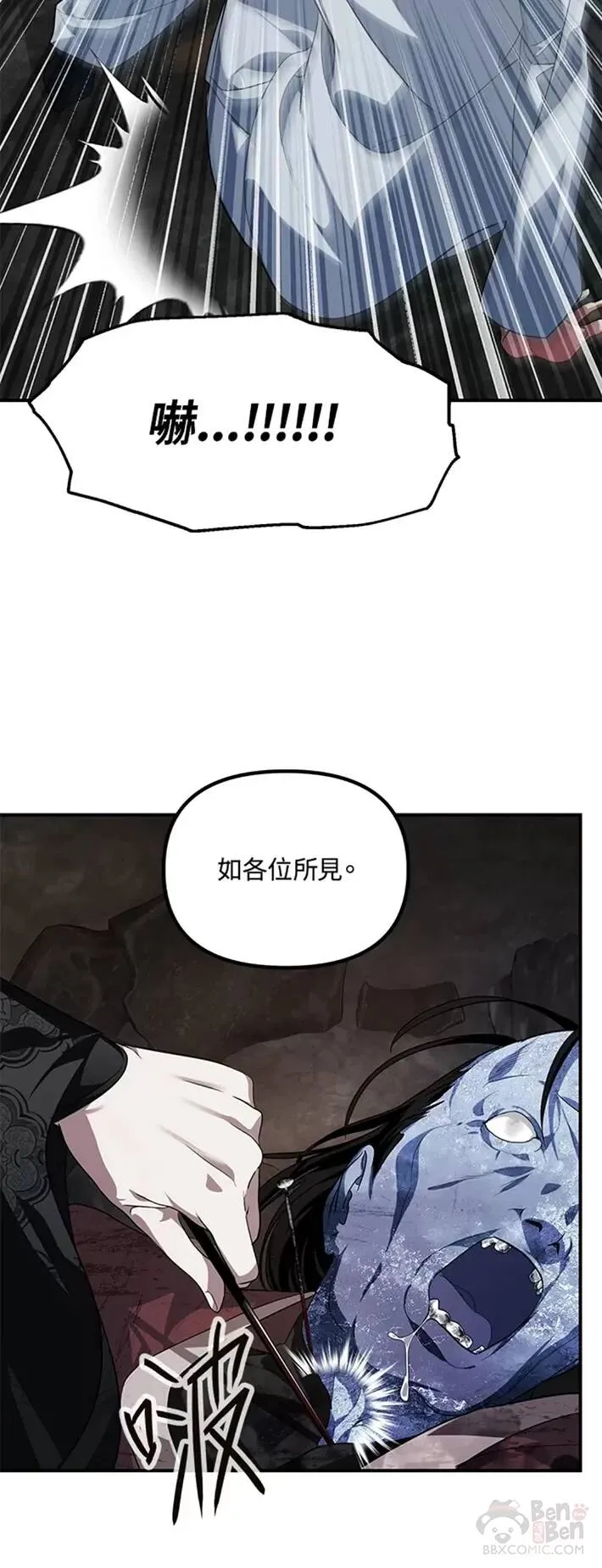 双肾衰竭做肾移植可以活多久漫画,第57话1图