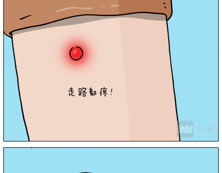 叫我森先生漫画,第361话 火疖子1图