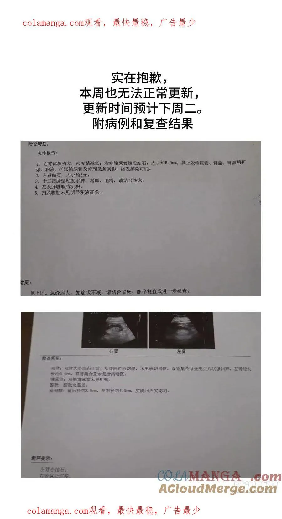 与死亡同行从鱼人地下城开始38话漫画,抱歉，本周更新也要延迟1图